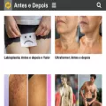 antesedepois.com.br antesedepois.com.br