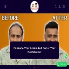 malhotrahair.in malhotrahair.in