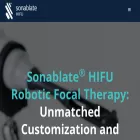 sonablate.com sonablate.com